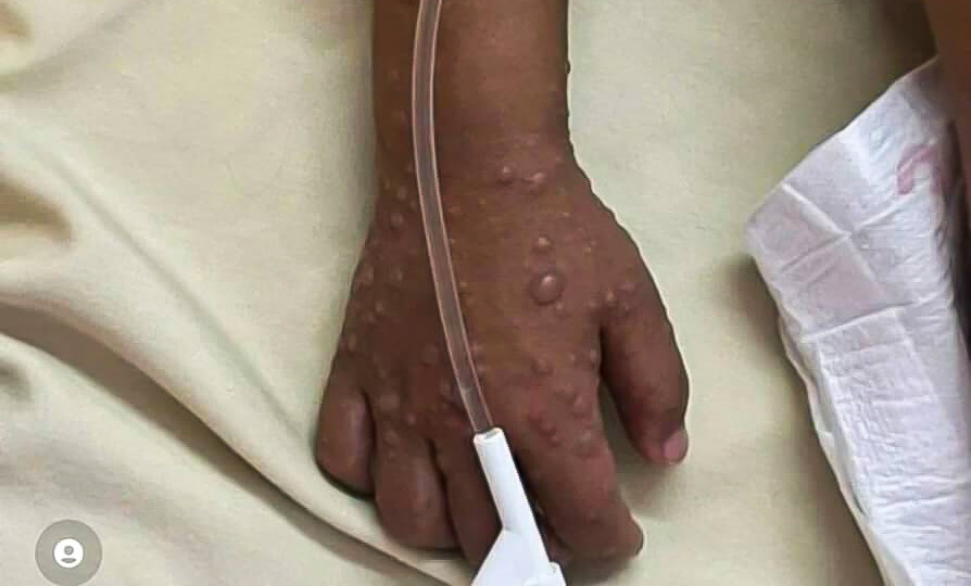 4255329
